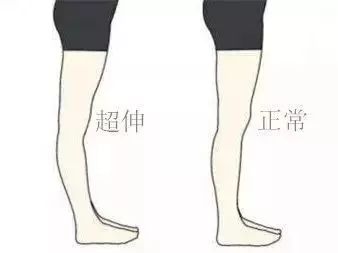 疼腳踝能運(yùn)動(dòng)好后會(huì)疼嗎_運(yùn)動(dòng)后腳踝疼 多久能好_腳踝痛還繼續(xù)運(yùn)動(dòng)會(huì)怎么樣