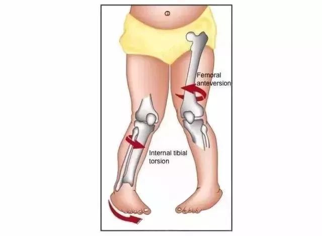 腳踝痛還繼續(xù)運(yùn)動(dòng)會(huì)怎么樣_疼腳踝能運(yùn)動(dòng)好后會(huì)疼嗎_運(yùn)動(dòng)后腳踝疼 多久能好