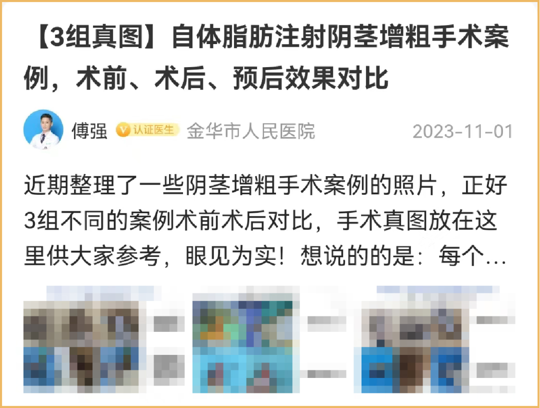 運動員要量陰莖嗎_運動員要量陰莖嗎_運動員要量陰莖嗎