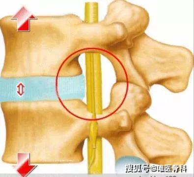 國內(nèi)反重力跑步機_alterg反重力跑步機官網(wǎng)_0重力跑步機