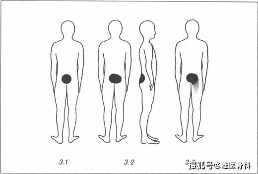 國內(nèi)反重力跑步機_0重力跑步機_alterg反重力跑步機官網(wǎng)