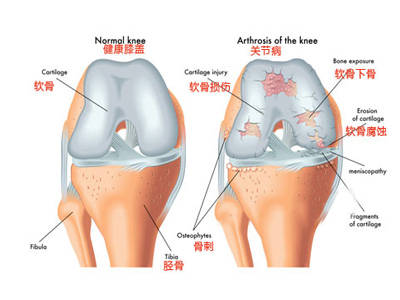 跑步擺腿動(dòng)作要領(lǐng)_跑步的擺腿訓(xùn)練_跑步后擺腿教學(xué)