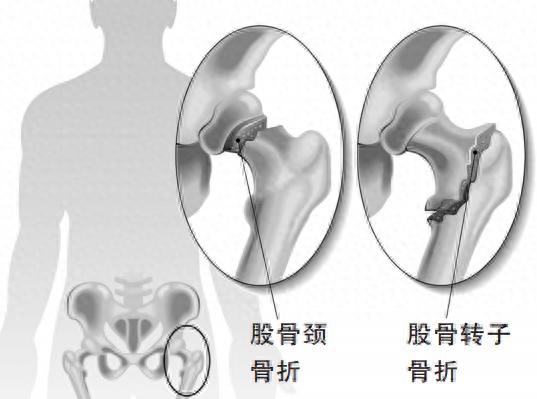 靠墻靜蹲可以練大腿肌肉嗎_練靠墻靜蹲可以瘦腿嗎_靠墻靜蹲能練出肌肉嗎