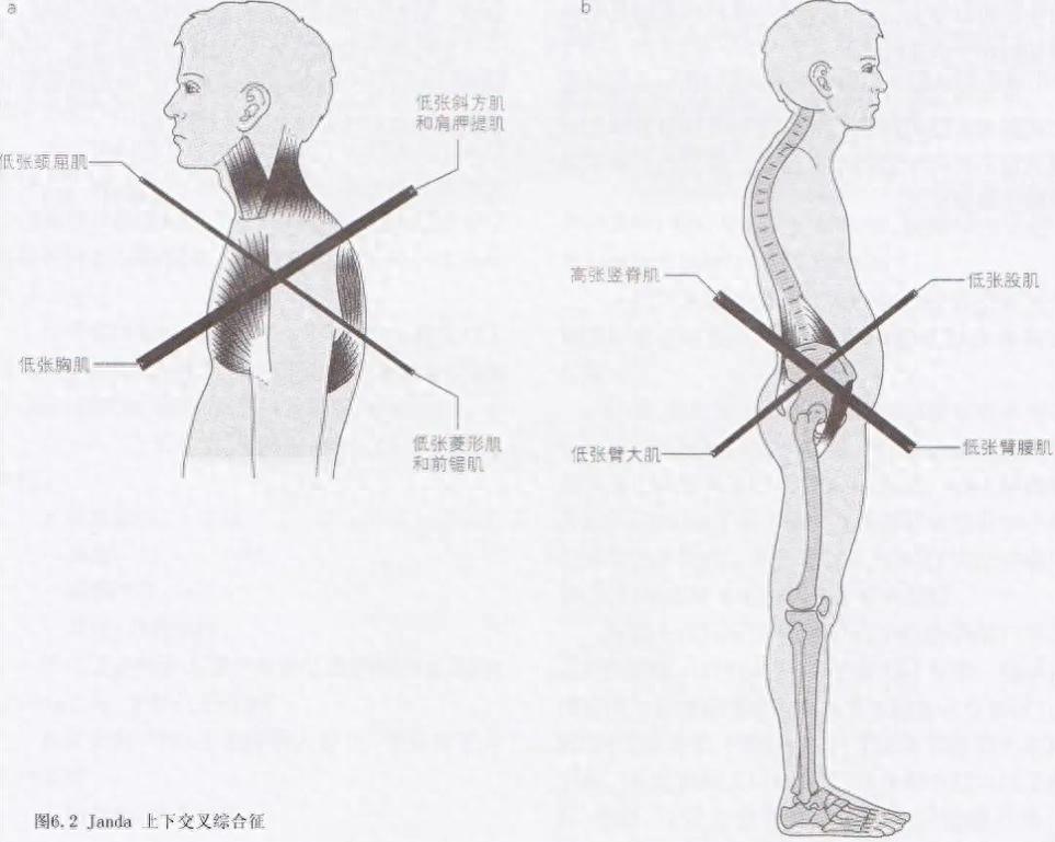 靠墻靜蹲能練出肌肉嗎_靠墻靜蹲能練腹肌嗎_靠墻靜蹲可以練核心力量嗎