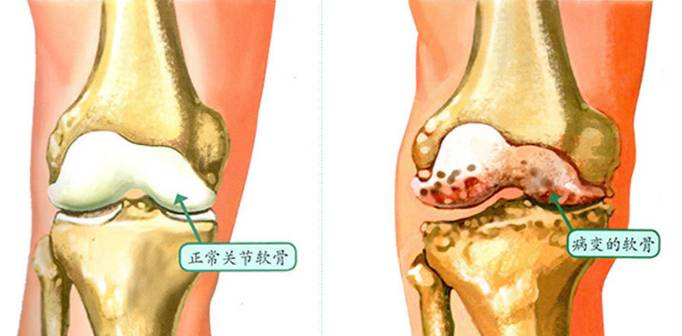 每天一萬(wàn)步能減肥嗎_關(guān)聯(lián)微信運(yùn)動(dòng)的計(jì)步器_微信運(yùn)動(dòng)一萬(wàn)步距離