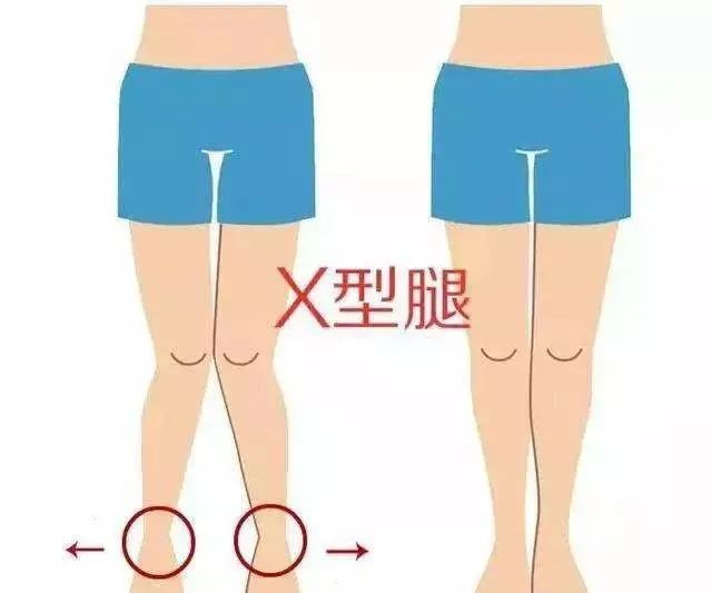 改善x型腿的瑜伽_瑜伽腿型矯正_瑜伽改變腿型