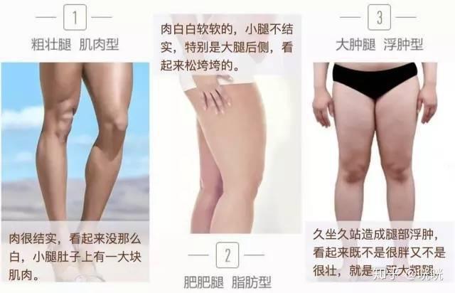 脂肪腿訓(xùn)練_瘦腿操下載_肌肉腿矯正
