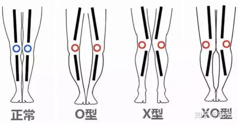 肌肉腿矯正_瘦腿操下載_脂肪腿訓(xùn)練