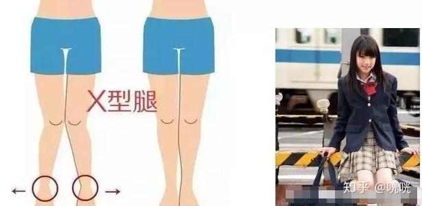 脂肪腿訓(xùn)練_肌肉腿矯正_瘦腿操下載