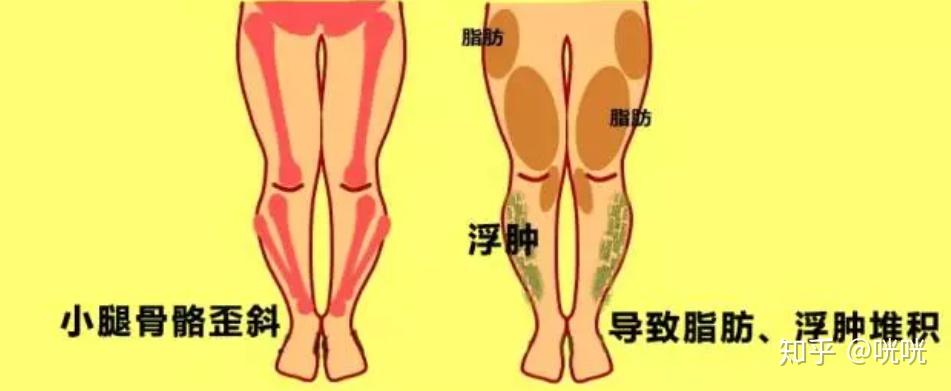 瘦腿操下載_肌肉腿矯正_脂肪腿訓(xùn)練
