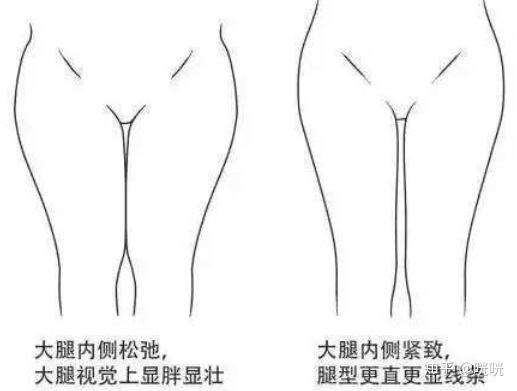 肌肉腿矯正_脂肪腿訓(xùn)練_瘦腿操下載